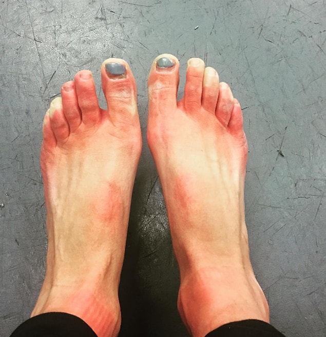 15. You try to warm up your feet with small movements in your toes.