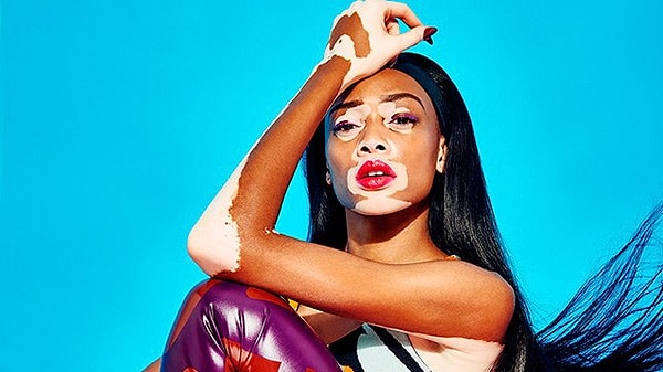 6. Винни Харлоу - модель с витилиго