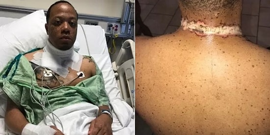 Telefonu Gece Yatarken Yanına Alıp Hayatının En Kötü Alarmıyla Uyanan Genç Adam