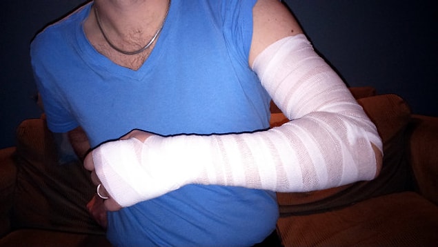 10. If you see someone who has an injury, instead of asking, "How did that happen?" ask, ''When are you getting rid of that cast?" or something like that.