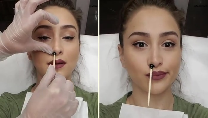 Burnundan Kıl Aldırmayan İnsanların Asla Yaptırmayacağı Şey: Burun Ağdası