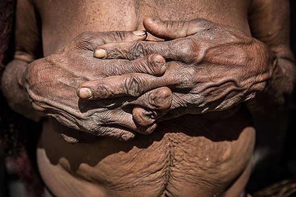 11. Мы надеемся, что настанет такое время, когда люди перестанут проводить такие жестокие ритуалы, ведь женщины не обязаны стыдиться своего тела!