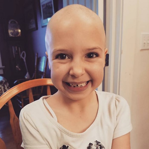 1. Эта 7-летняя девочка потеряла все свои волосы из-за алопеции, но это не остановило ее от появления на Дне безумных причесок в школе!