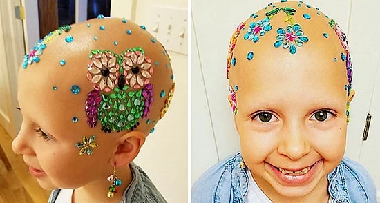 Saçkıran Rahatsızlığının Çılgın Saç Modeli Gününe Engel Olmasına İzin Vermeyen Güzel Kız!