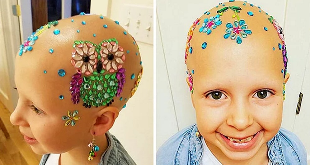 Saçkıran Rahatsızlığının Çılgın Saç Modeli Gününe Engel Olmasına İzin Vermeyen Güzel Kız!