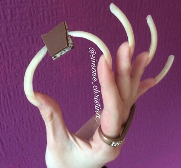 9. Однако у нее случались незначительные несчастные случаи.