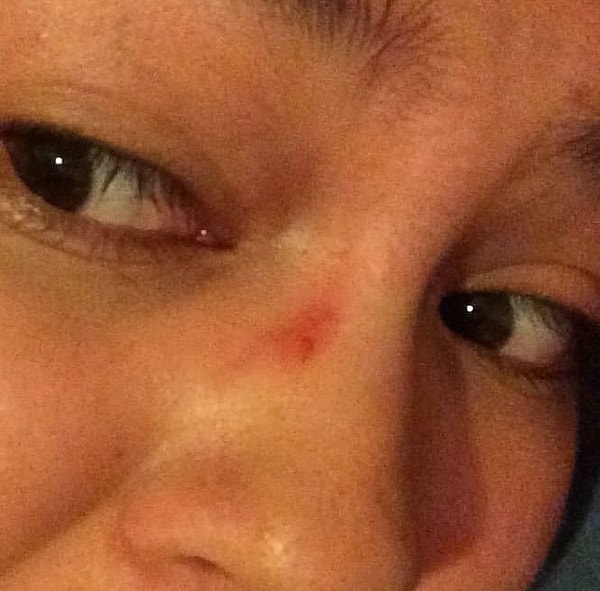 17. Вы можете только мечтать, чтобы эта дурацкая вмятина на носу не появлялась