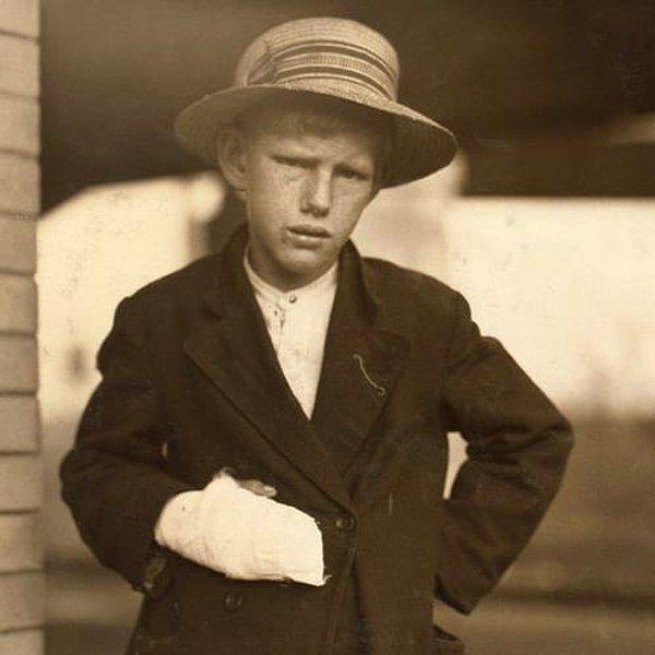 11. Kuzey Carolina'da pamuk fabrikasında elini incitmiş 13 yaşındaki bir çocuk işçi. Solda ise 1908'de dokuma işinde çalışan bir kız çocuğu.