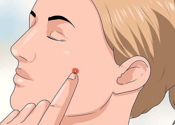 9. У вас не вовремя вскочил прыщик. Замаскировать его быстро поможет…