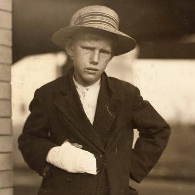 11. Left: Portrait of a 13-year-old boy with a hand injury he received while working at a cotton mill in Weldon, North Carolina, circa 1914. Right: A young girl pauses for a portrait while working on spinning machines in 1908.