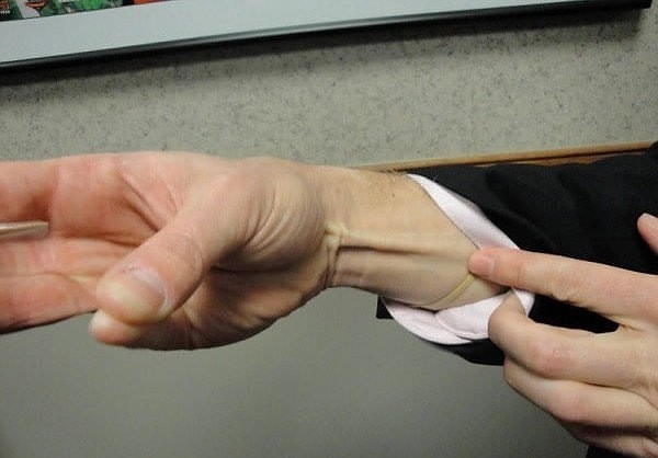 1. Длинная ладонная мышца