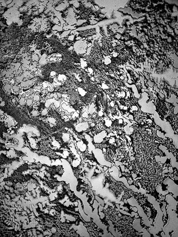 9. Внезапно выступившие слёзы