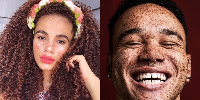 Birçok Kişinin Sevmediği Çillerin Akıllara Zarar Güzelliğini Kanıtlayan 17 Mükemmel Kare