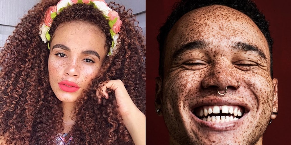 Birçok Kişinin Sevmediği Çillerin Akıllara Zarar Güzelliğini Kanıtlayan 17 Mükemmel Kare