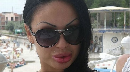 Страшно красивые: 20 жертв гламура