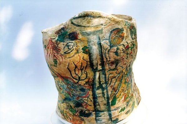 14. Гипсовый корсет