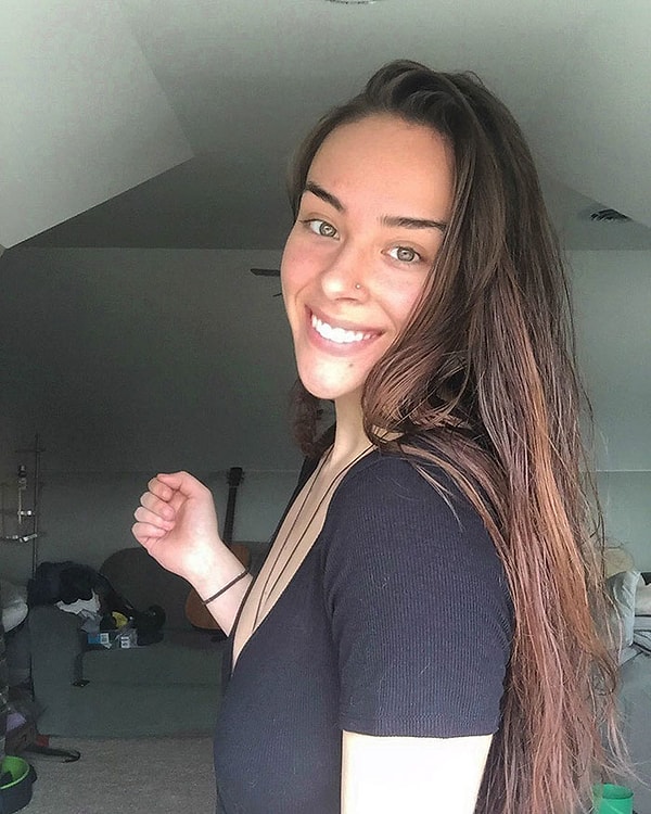 6. Когда девушке было 12, ее дразнили на уроках физкультуры за волосатые ноги