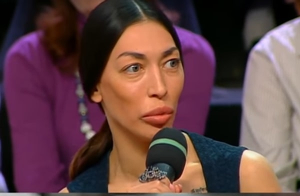 4. Но она так сильно увлеклась, что после очередного визита к пластическому хирургу врач посоветовал ей обратиться к психологу.