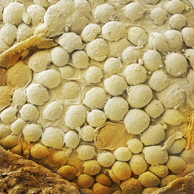 9. A sesame seed.