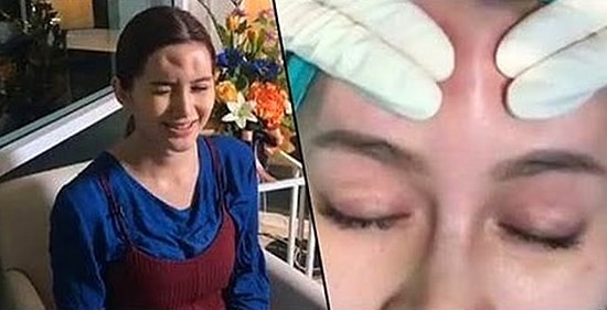 Alnından Çıkan Sıvıyla Adeta Beynini Akıtan Kadının 'Aşırı İğrenç' Videosu