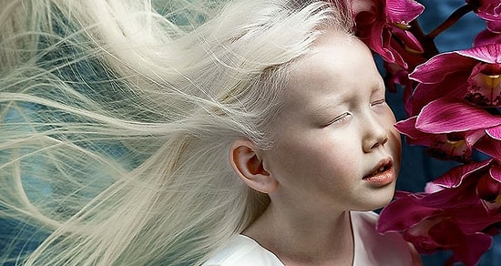 Сибирская Белоснежка: девочка-альбинос, поразившая модельные агенства уникальной красотой