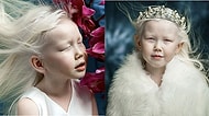Güzelliği ile Ünlü Ajansları Peşinden Koşturan 8 Yaşındaki Albino Pamuk Prenses Nariyana