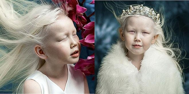 Güzelliği ile Ünlü Ajansları Peşinden Koşturan 8 Yaşındaki Albino Pamuk Prenses Nariyana