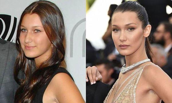 7. Probably everyone's aware of how much 20-year-old Bella Hadid has changed from before she become a model.