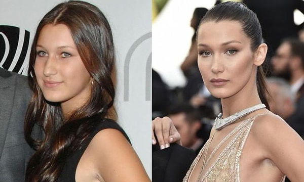 7. Probably everyone's aware of how much 20-year-old Bella Hadid has changed from before she become a model.