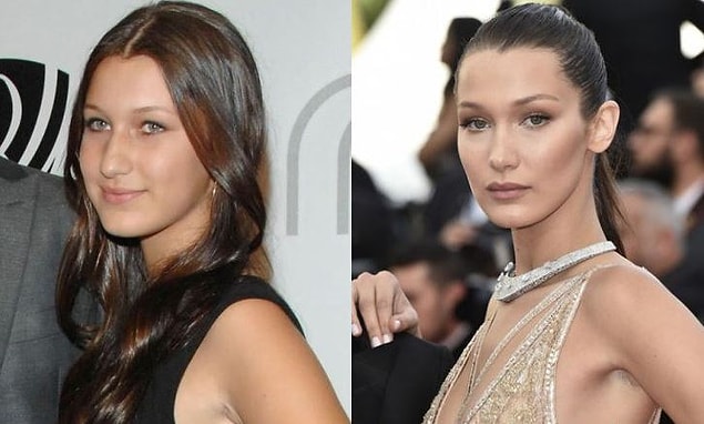 7. Probably everyone's aware of how much 20-year-old Bella Hadid has changed from before she become a model.