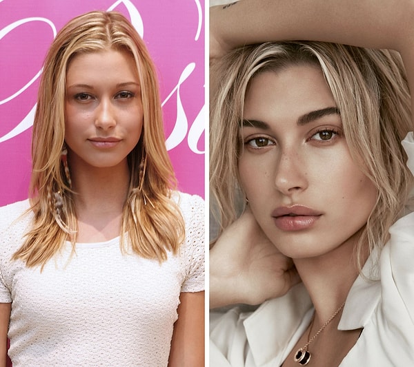 8. 20-year-old model, Hailey Baldwin looked so different when she was 14 years old. Apparently, facial injections helped Baldwin achieve her current look.