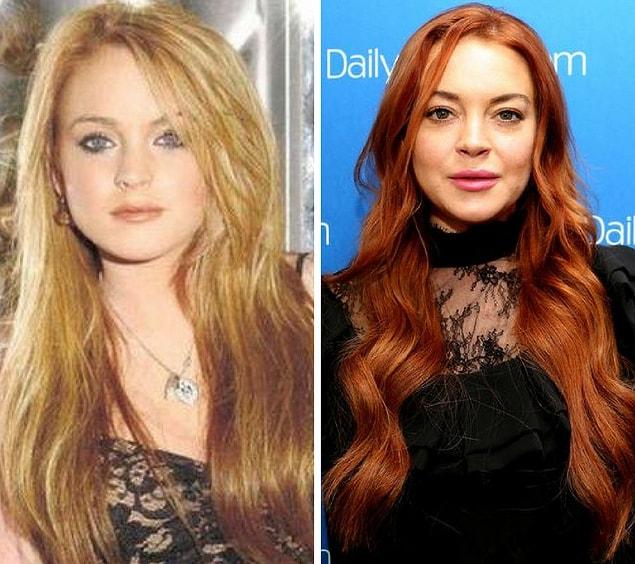 9. Lindsay Lohan was just a child when she gained worldwide recognition. The child star took an early entrance into the world of plastic surgery and couldn't go out since then.