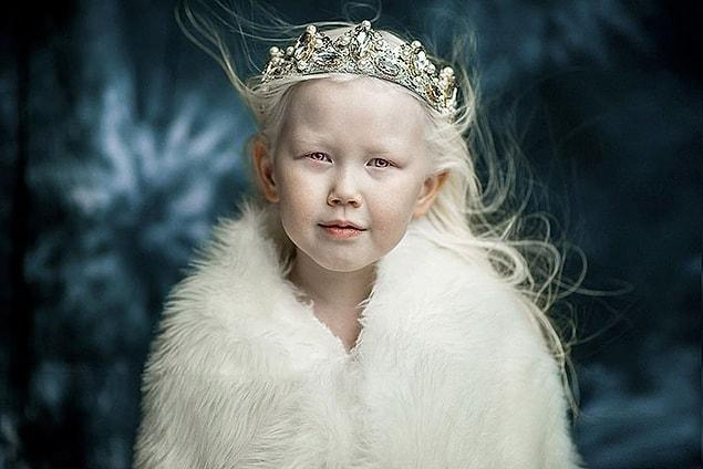 1. This is Nariyana.. Nariyana is an eight year old albino girl who is currently at the spotlight of modelling agencies.