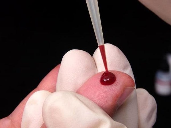 3. Почему существуют разные группы крови?