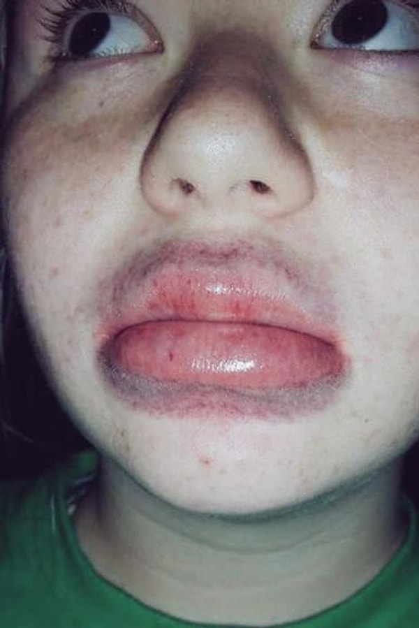 2. Мода делать губы пухлее всевозможными способами