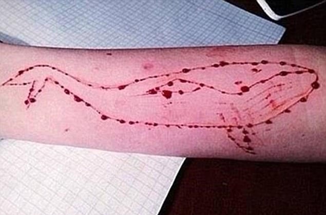 Kendilerine acı vermeleri ile alakalı olan göreve örnek olarak aşağıdaki fotoğrafı gösterebiliriz. Kanlar içinde kalan kız, görev olarak koluna balina çizmiş.