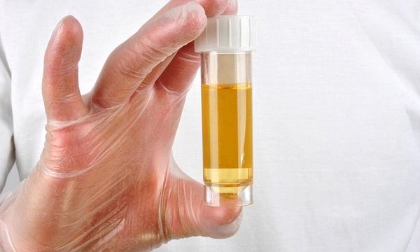 15. Моча содержит около 3000 компонентов, но в основном она состоит из воды