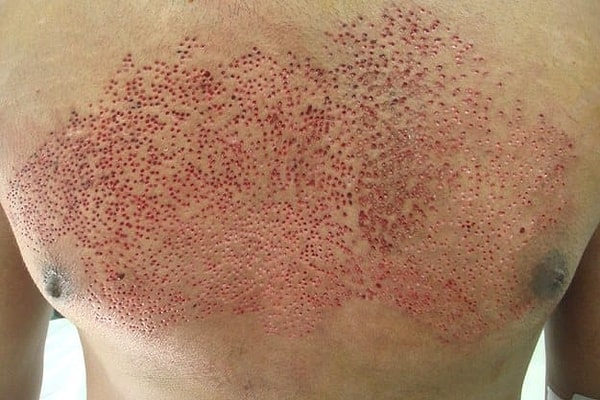 8. Кстати, вы случайно не трипофоб? Продолжим тест?