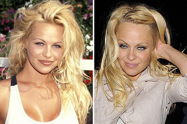 12. Памела Андерсон