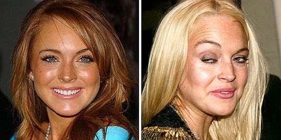 20 шокирующих фотографий знаменитостей "до и после" принятия наркотиков