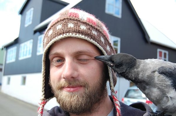 10. "Подтяжка век"