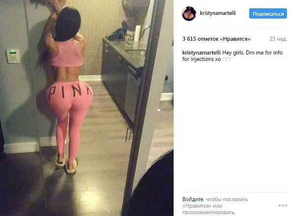 8. Страсть к пластическим операциям принесла Мартелли 620 тыс. подписчиков в Instagram и помогла ей заняться модельным бизнесом