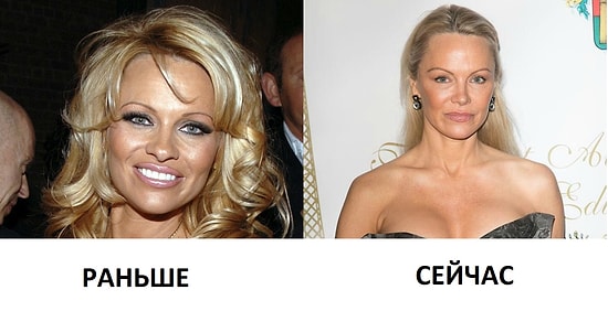 Все в восторге от нового образа Памелы Андерсон!