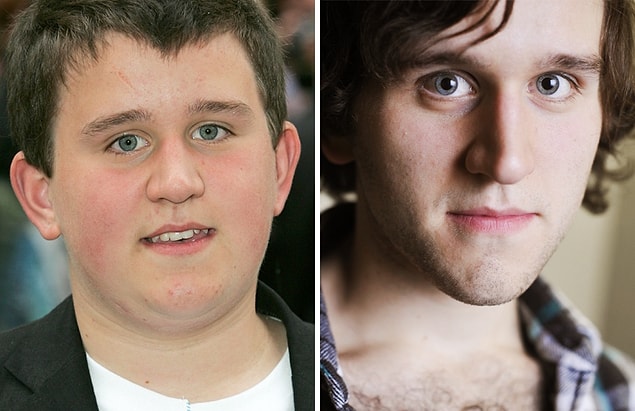 2. Harry Melling