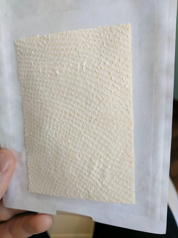 5. Но затем вирус начал распространяться - одна бородавка вскоре превратилась в пять. Лечение не работало