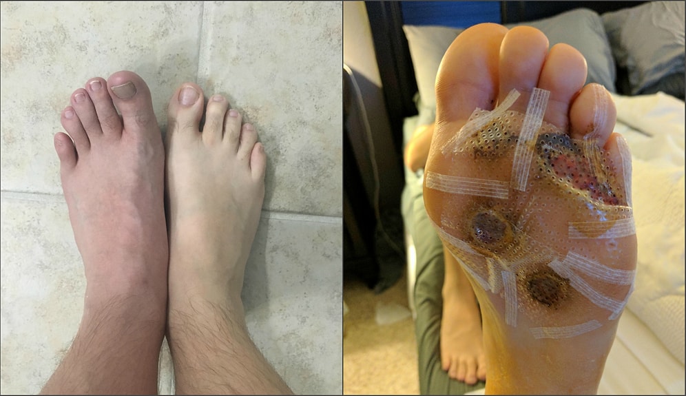 После истории этого мужчины вы НИКОГДА не станете ходить босиком в бассейне или душе спортзала!