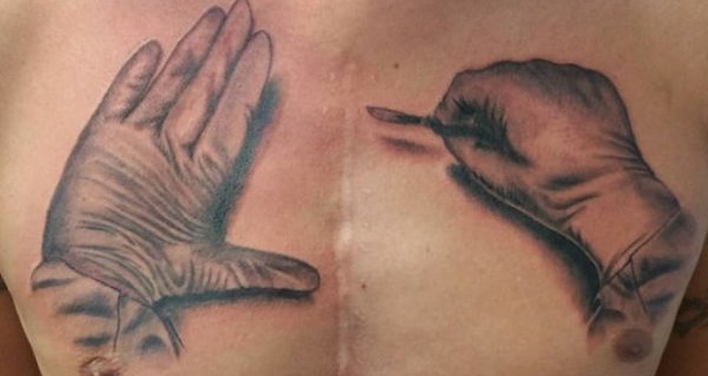 26 невероятных татуировок, призванных скрыть шрамы