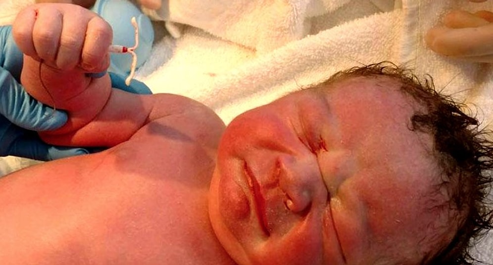 'Seçilmiş' Kişi! %99 Güvenlik Sağlayan Doğum Kontrol Yöntemine Rağmen Dünyaya Gelen Çocuk