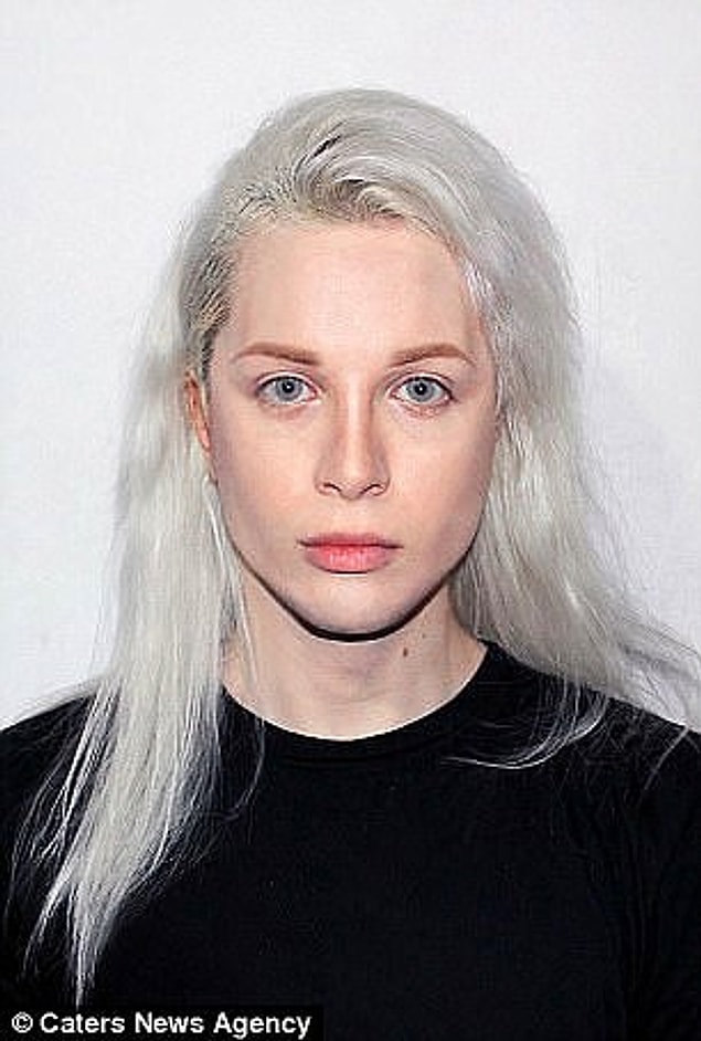 At the age of 14, he was determined to undergo surgery to look more like an elf and six years later he went under the knife for the first time.