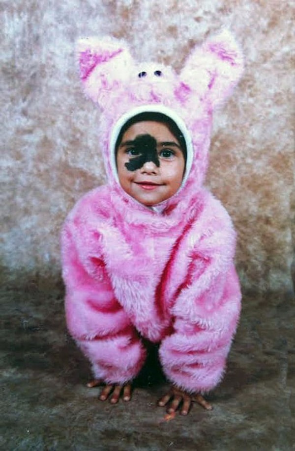 3. В 5 лет Мендес сделали лазерную операцию, чтобы убрать родимое пятно